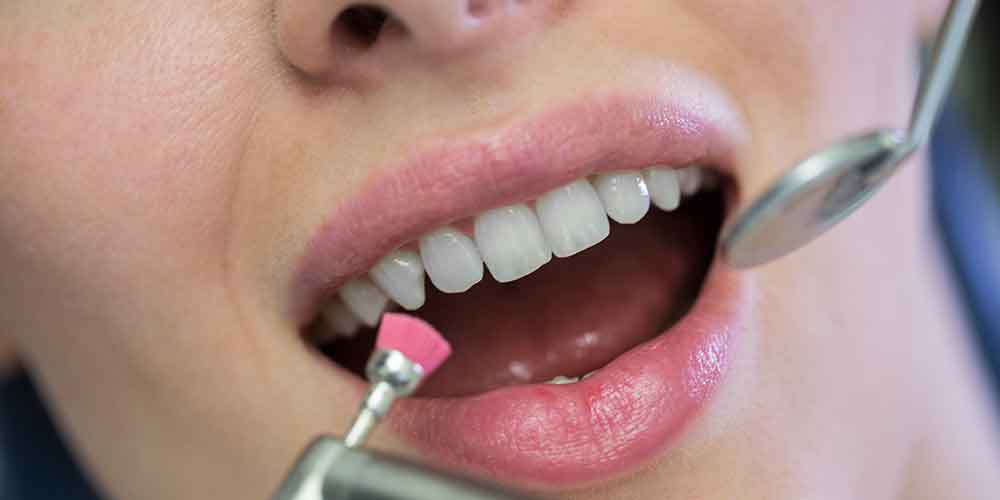Teeth Care and Teeth Cleaning: Secrets to a Healthy Smile