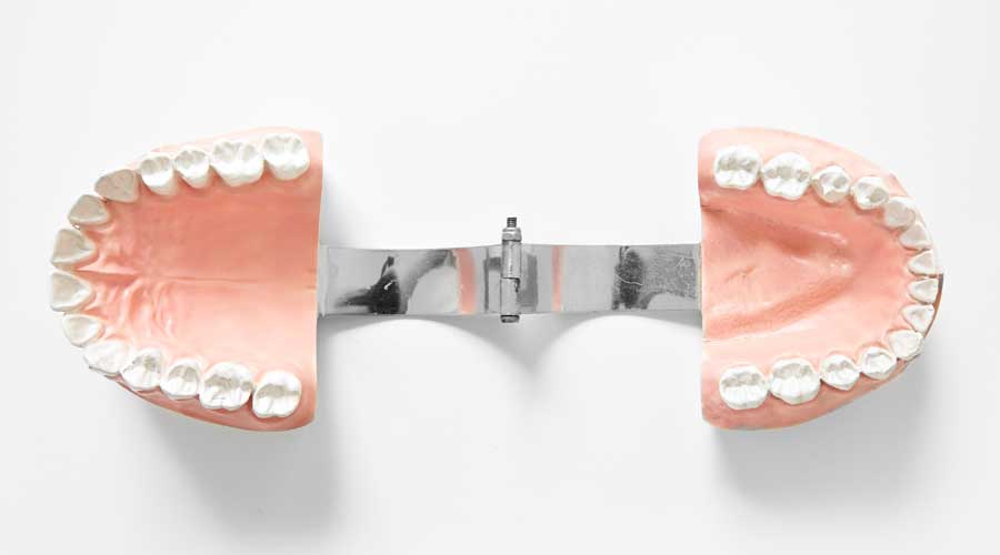 Unveiling the Potential of Tooth Prosthesis