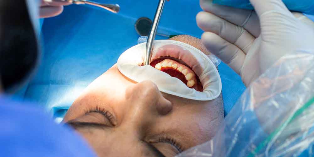 Exploring Advanced Dental Treatments: A Comprehensive Guide