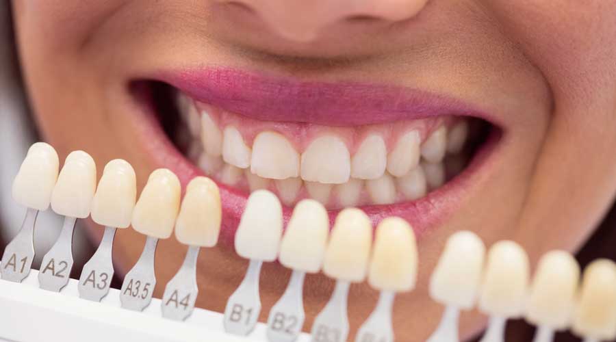 Unlocking the Secrets to Superior Oral Care: The Best Teeth Treatment Options