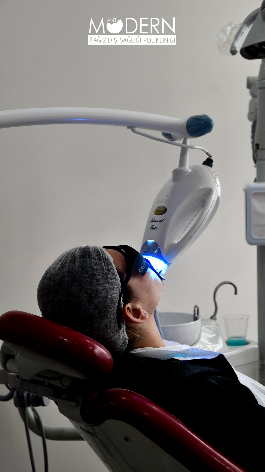 Teeth Whitening Methods and Recommendations